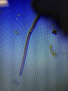 fungal-hypha